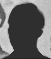 A silhouette of the face of Private Roderick Schneider. Schneider became an expert at driving dog teams during the expedition.